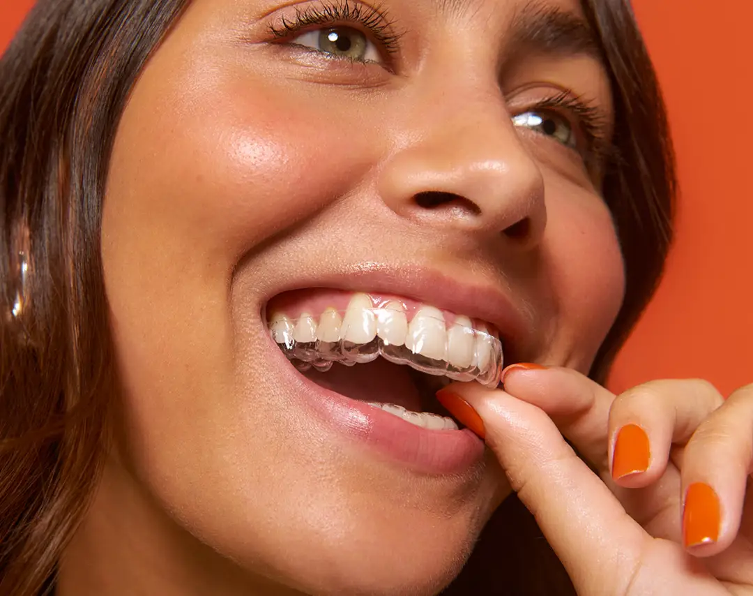 Alinhadores Invisíveis: a tecnologia por trás do sorriso discreto